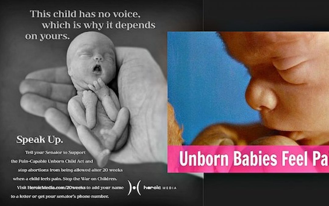 President Trump Wants Pain-Capable Abortion Ban (None After 20 Weeks)