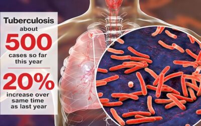 New York City Suffers Skyrocketing Cases of Tuberculosis Amid Influx of Illegals